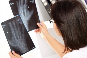 Araxá amplia subespecialidades para cirurgias ortopédicas